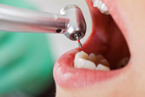Best Urgent Dental Care for Toothache in New Market, TN